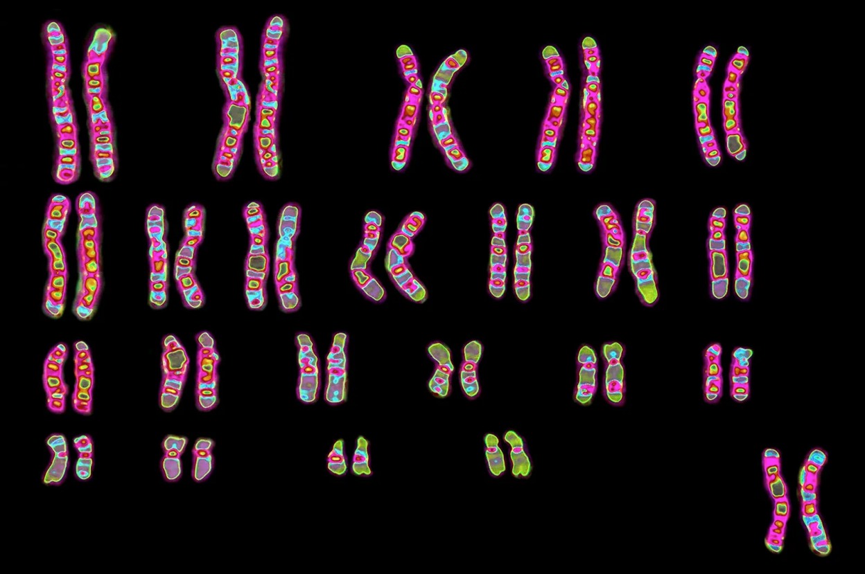 Karyotype human chromosomes microscope